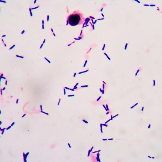 Desert Elf: How Leishmaniasis Turns a "Beautiful Face" into a "Monster Face"