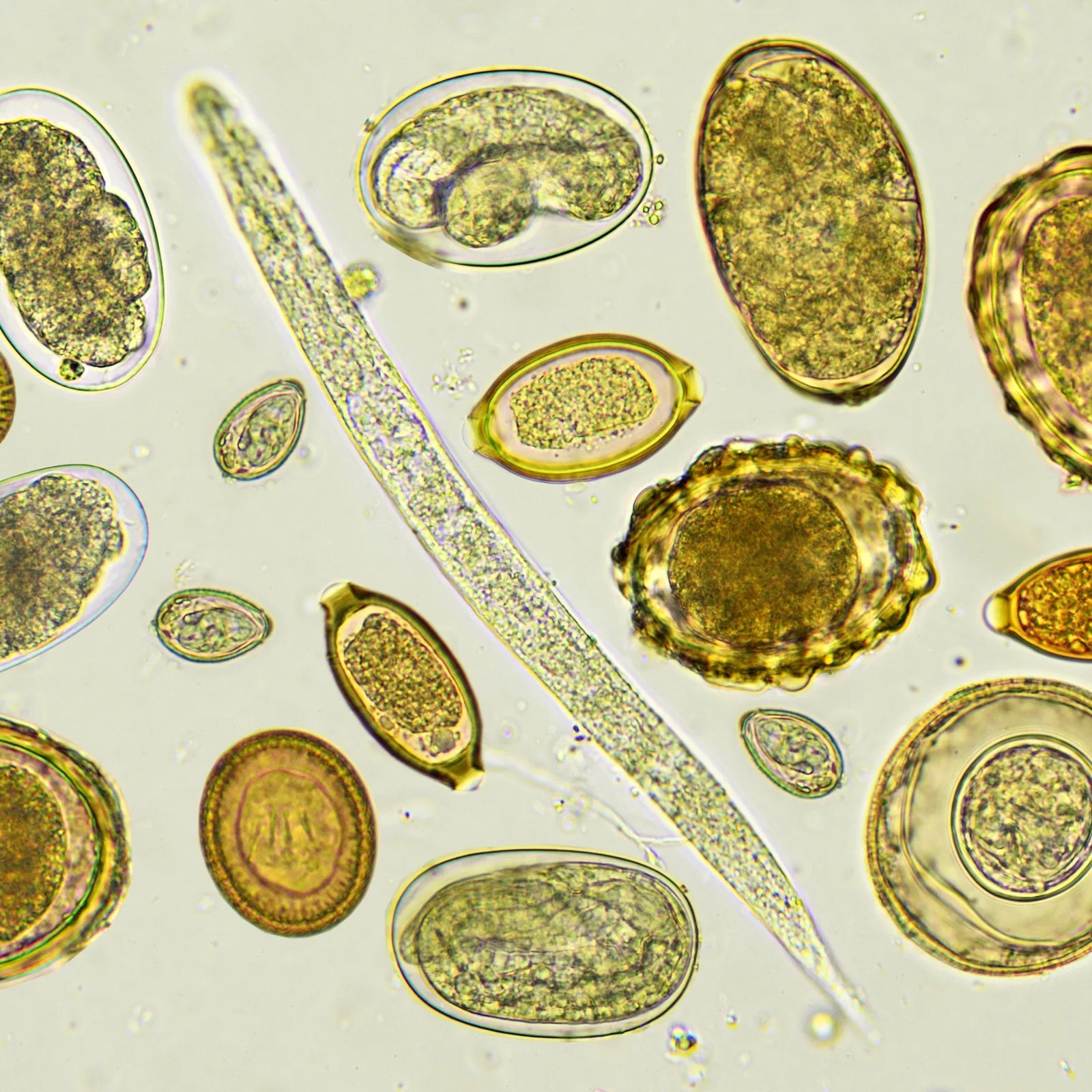 Parasite Cleansing: What You Need to Know