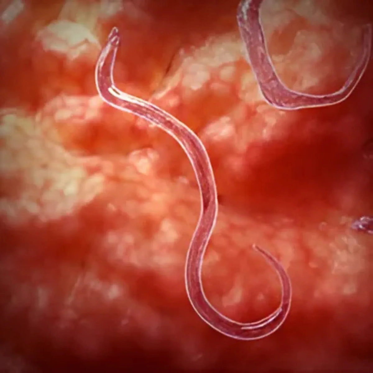 Vampire Disease Blog
