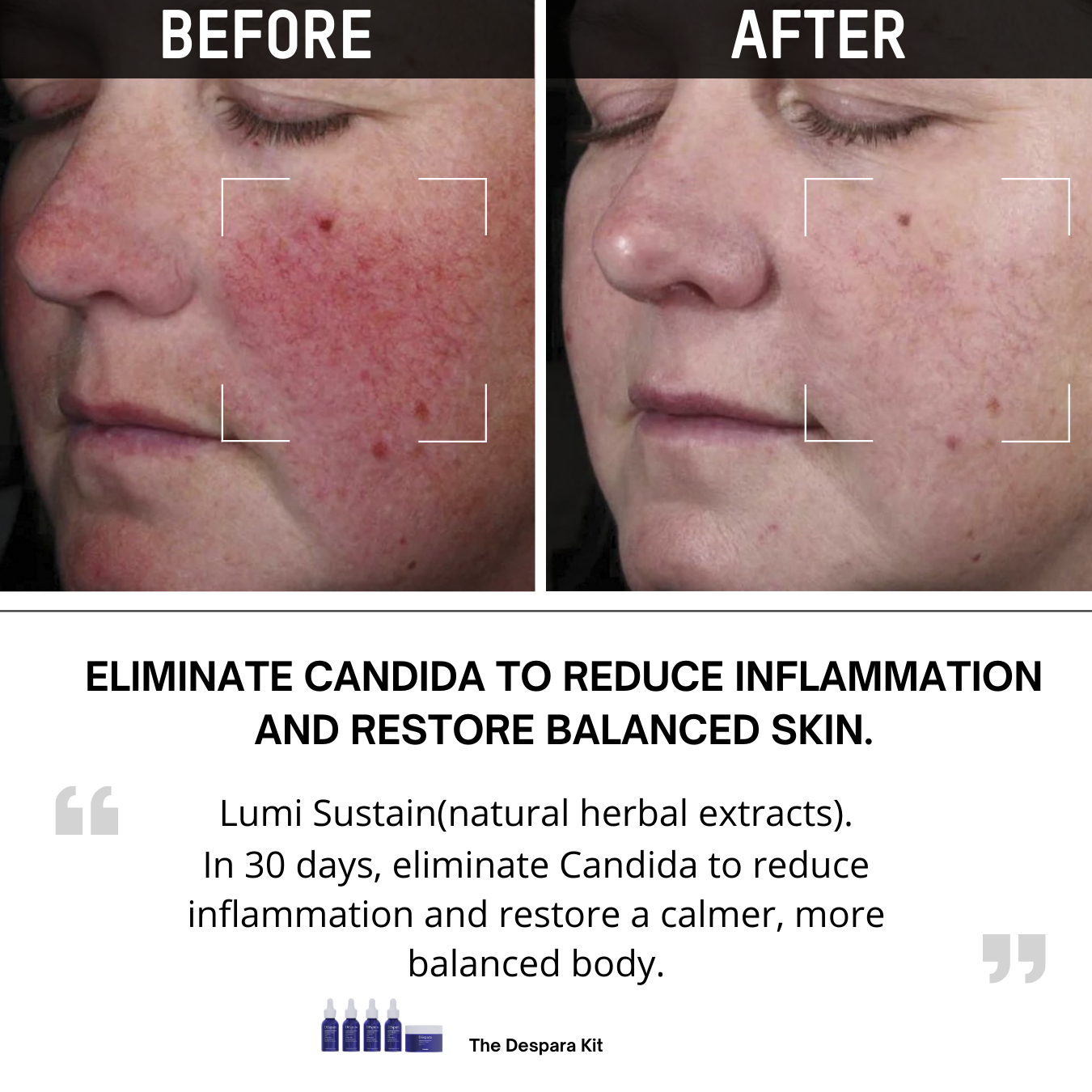 Lumi Sustain-Despara life