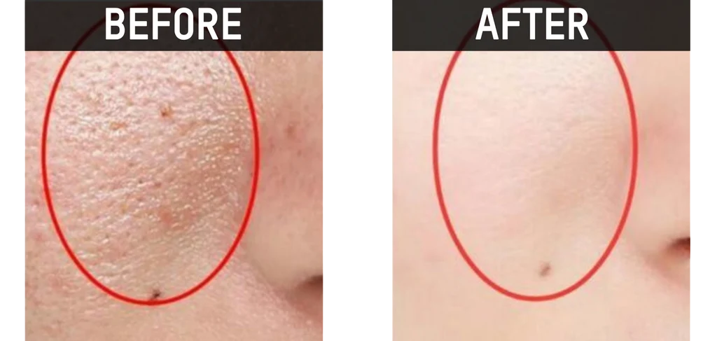 CLINICAL TRIALS CANNOT LIE.