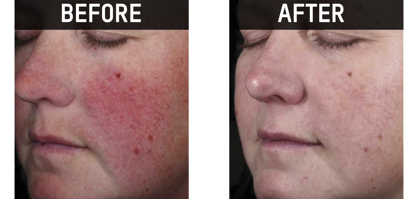 CLINICAL TRIALS CANNOT LIE.